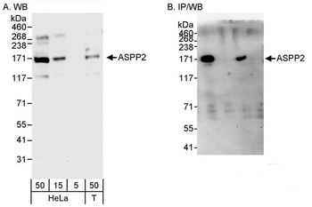 Rabbit anti-ASPP2 Antibody