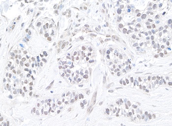 TIF1 Alpha/TRIM24 Antibody