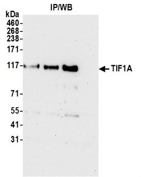 TIF1 Alpha/TRIM24 Antibody