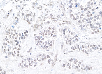 Rabbit anti-TIF1 Alpha/TRIM24 Antibody