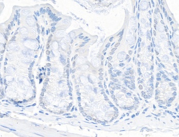 Rabbit anti-TIF1 Alpha/TRIM24 Antibody