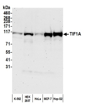 Rabbit anti-TIF1 Alpha/TRIM24 Antibody