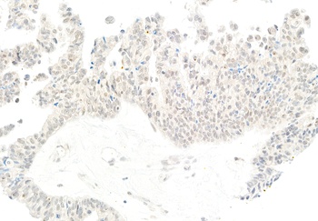 Rabbit anti-PIMT Antibody