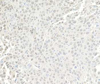 Rabbit anti-BRG1/SMARCA4 Antibody