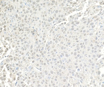 BRG1/SMARCA4 Antibody