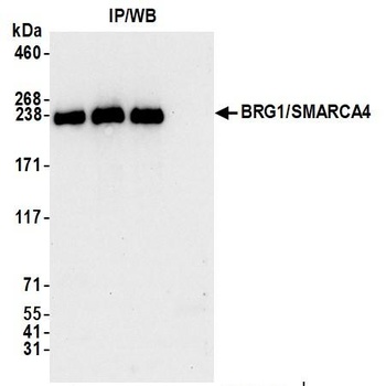 Rabbit anti-BRG1/SMARCA4 Antibody