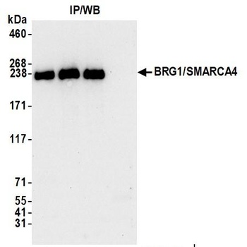 BRG1/SMARCA4 Antibody