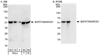 Rabbit anti-BAF57/SMARCE1 Antibody