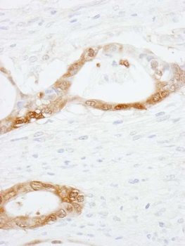 Rabbit anti-CRABP2 Antibody