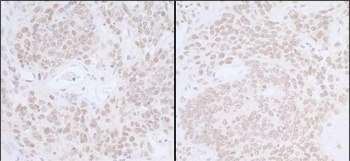 Rabbit anti-SUPT6H Antibody