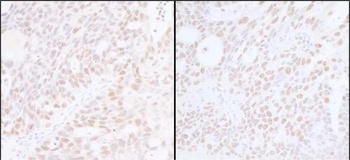 SUPT6H Antibody