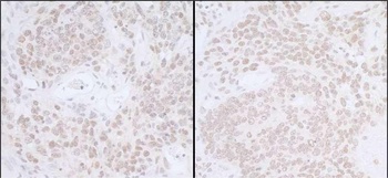 SUPT6H Antibody