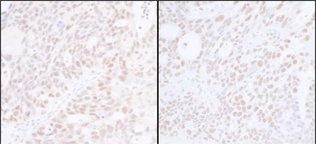 Rabbit anti-SUPT6H Antibody