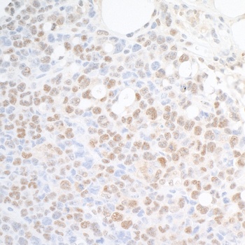 Rabbit anti-SUPT6H Antibody
