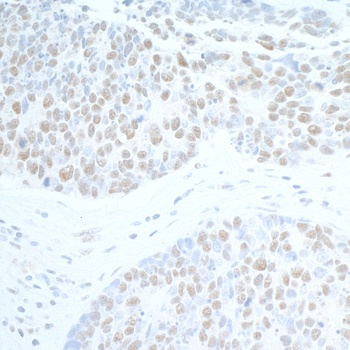 Rabbit anti-SUPT6H Antibody