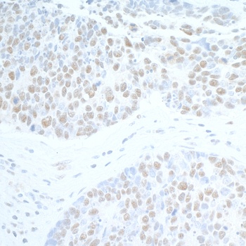 SUPT6H Antibody