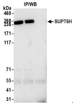 Rabbit anti-SUPT6H Antibody