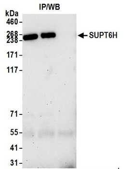 SUPT6H Antibody