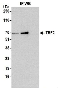 Rabbit TRF2 Antibody
