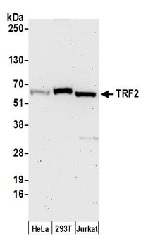 Rabbit TRF2 Antibody