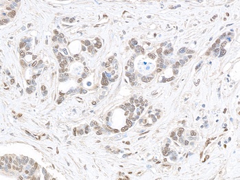 Rabbit anti-MED1 Antibody