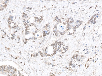 MED1 Antibody