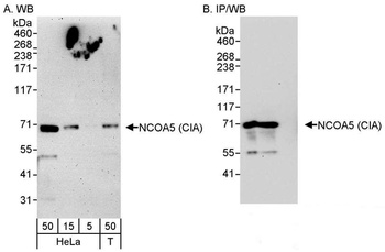 Rabbit anti-NCOA5/CIA Antibody