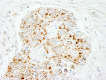 Rabbit anti-MAVS/VISA Antibody