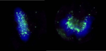 Rabbit anti-ZWINT-1 Antibody