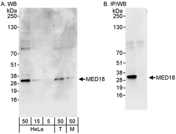 Rabbit anti-MED18 Antibody