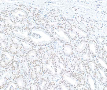 Rabbit anti-MED12 Antibody