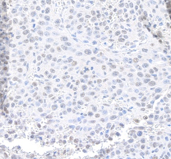Rabbit anti-MED12 Antibody