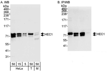 Rabbit HEC1 Antibody