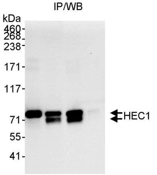 Rabbit HEC1 Antibody