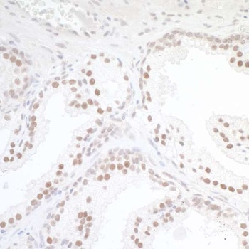 Rabbit anti-TORC1 Antibody