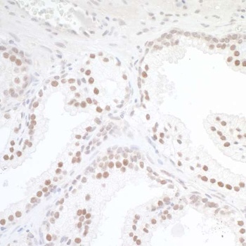 TORC1 Antibody