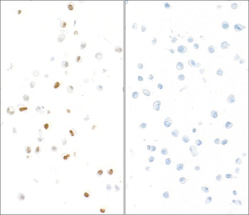 KAP-1, Phospho (S824) Antibody