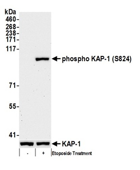 KAP-1, Phospho (S824) Antibody