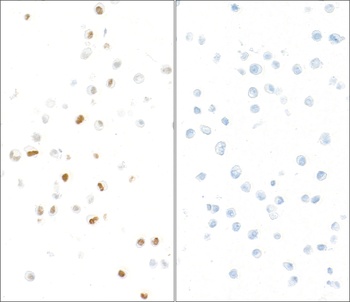 Rabbit anti-Phospho KAP-1 (S824) Antibody