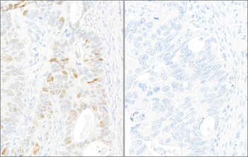 Rabbit anti-Phospho KAP-1 (S824) Antibody