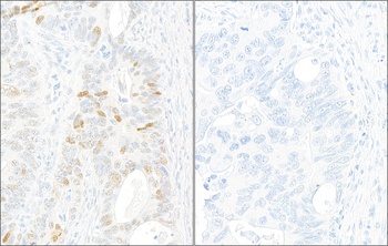 KAP-1, Phospho (S824) Antibody