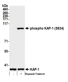 Rabbit anti-Phospho KAP-1 (S824) Antibody