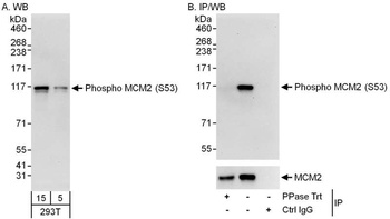 Rabbit anti-Phospho MCM2 (S53) Antibody