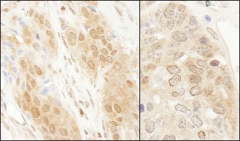 Rabbit anti-DJ-1 Antibody