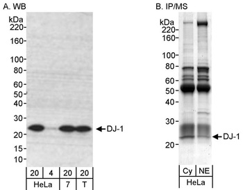 Rabbit anti-DJ-1 Antibody