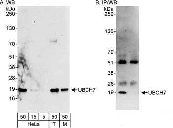 Rabbit anti-UBCH7 Antibody