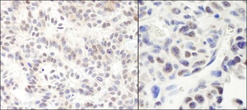 Rabbit HMG2a Antibody