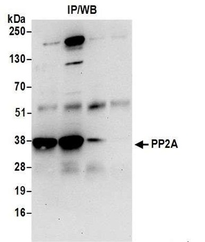 Rabbit PP2A Antibody