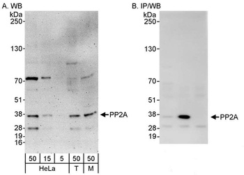 Rabbit PP2A Antibody