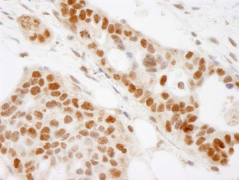 Rabbit BAAT1 Antibody